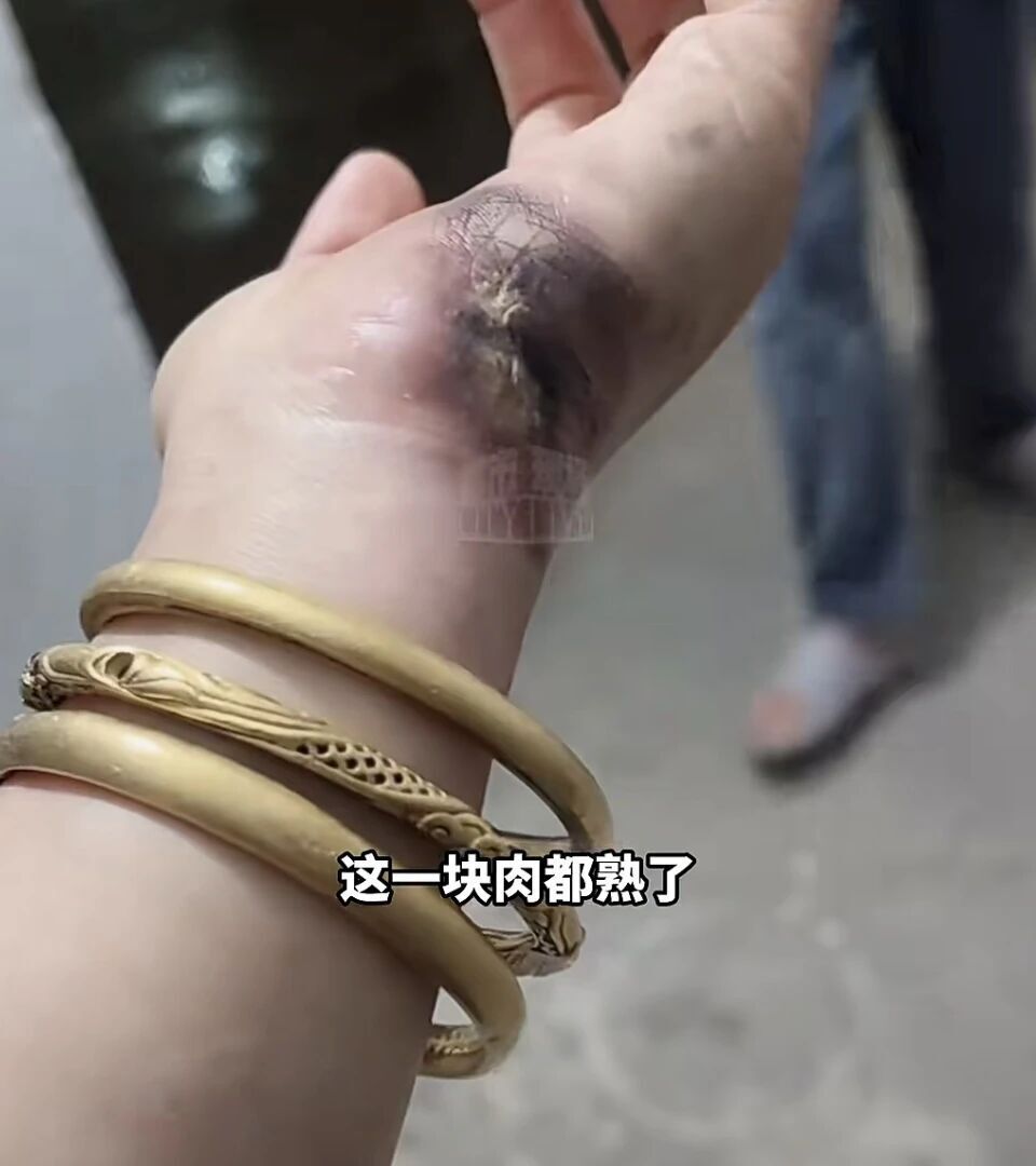 女子称给电动车充电金镯子被电碎