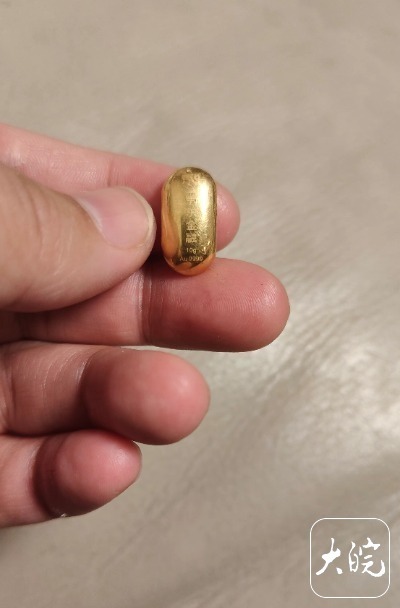 熊孩子误吞10克金豆6天后排出