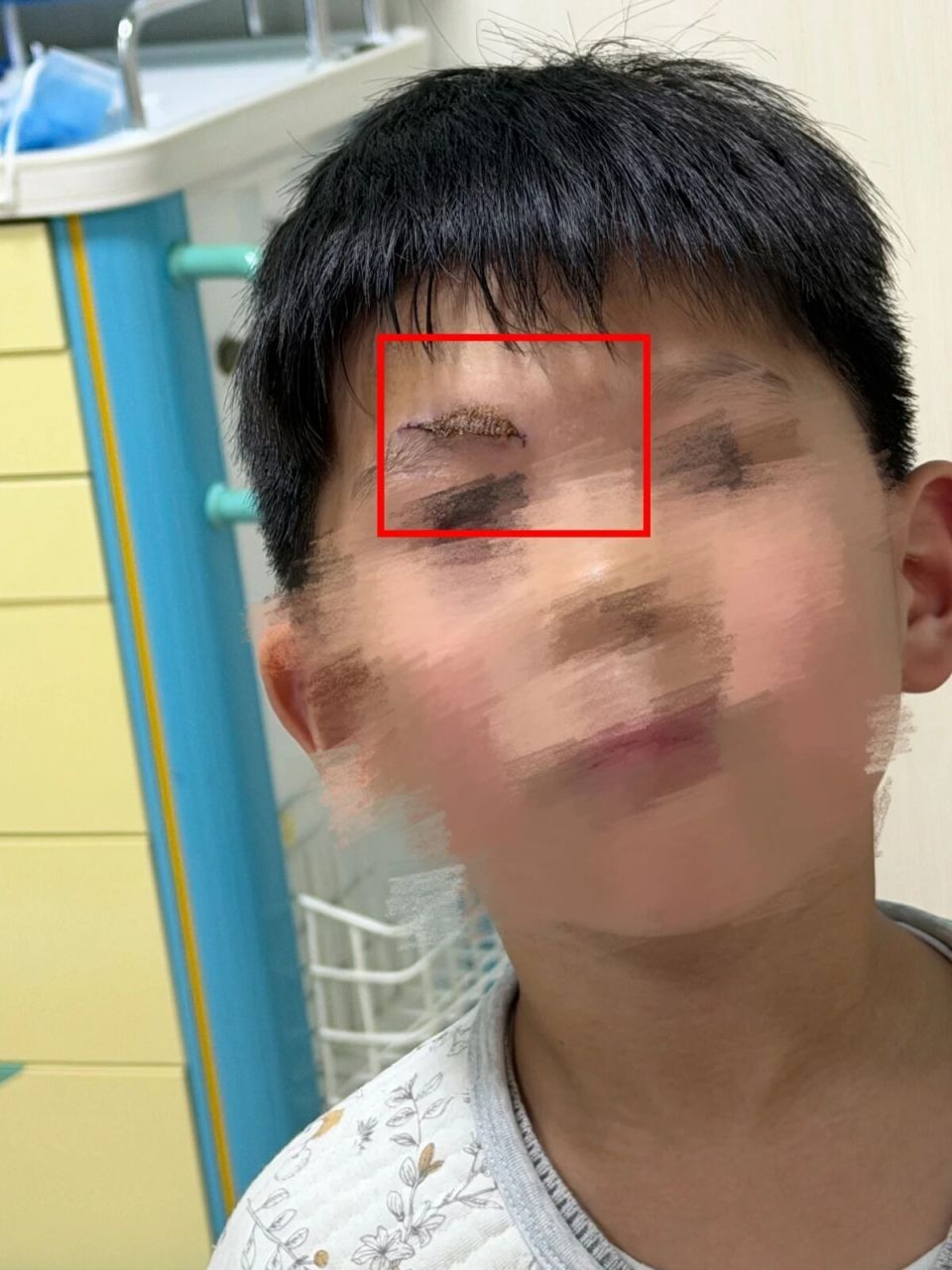 男童游乐场摔伤家长索祛疤费遭拒 男童游乐场摔伤家长索祛疤费遭拒