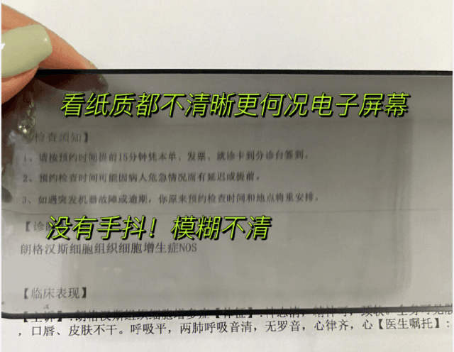 手机贴的防窥膜其实很伤眼