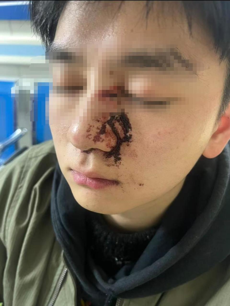 男子因质问遛狗不牵绳被打案二审