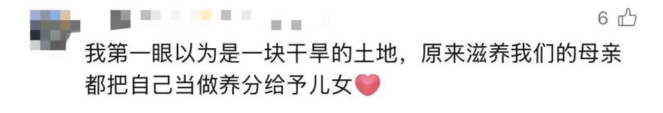 92年宝妈产后腹直肌严重分离