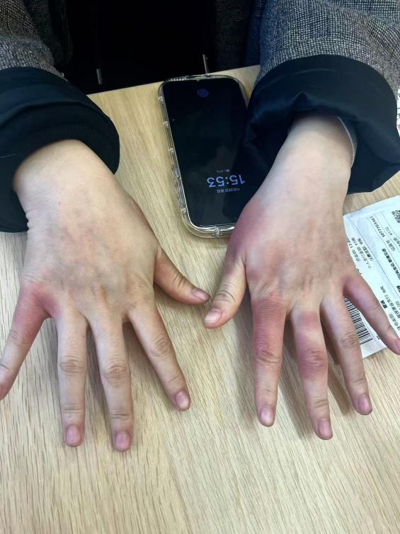 东北人在南方崩溃：穿3条加绒裤仍冷