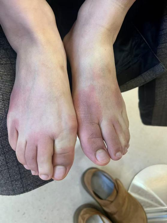 东北人在南方崩溃：穿3条加绒裤仍冷