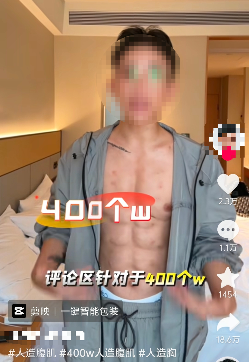 花7万打83针玻尿酸不健身速成腹肌