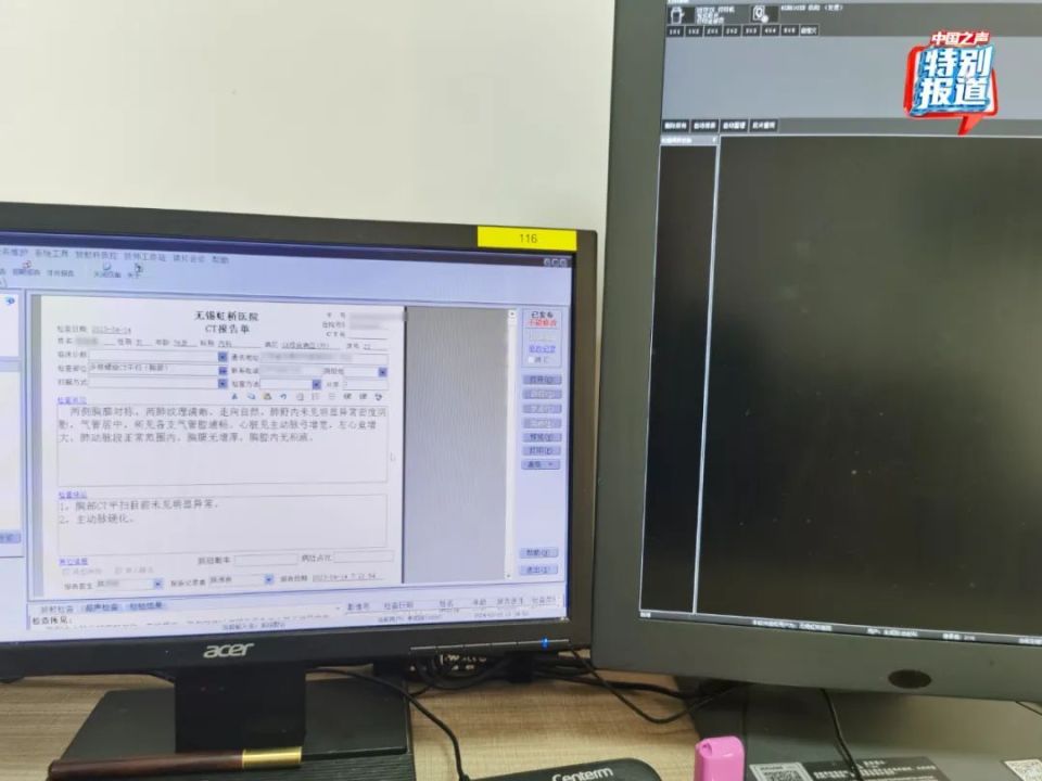 患者没挂上号医生蹲在地上看CT片