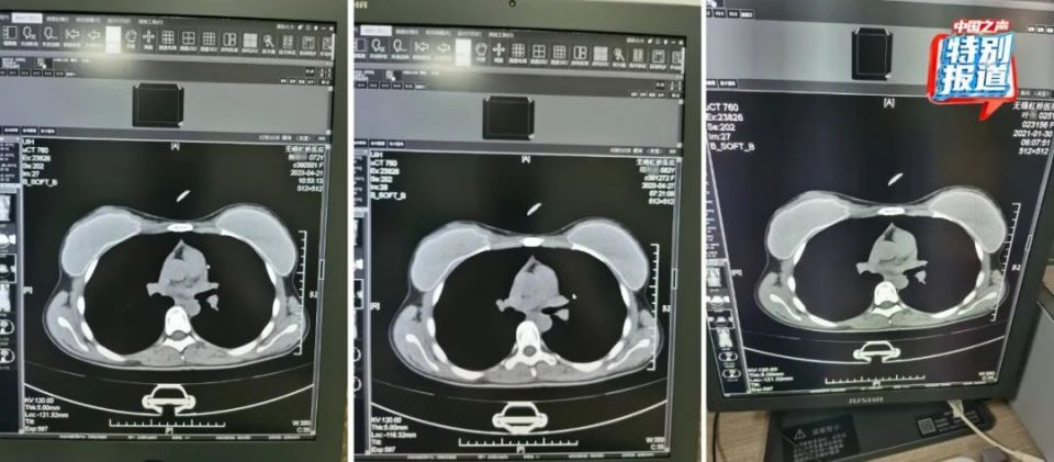 患者没挂上号医生蹲在地上看CT片